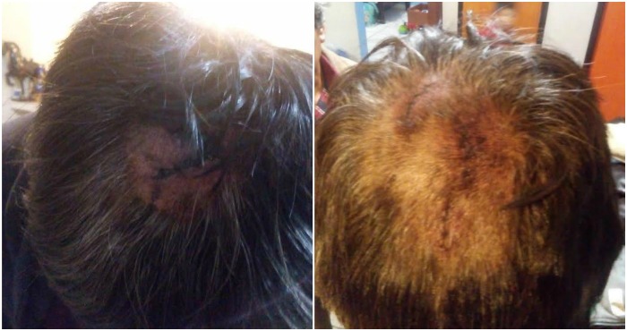 Don Zeferino (89 años) y su hijo Sergio (56 años) fueron amordazados en su domicilio y golpeados de manera brutal. Foto: Especial.