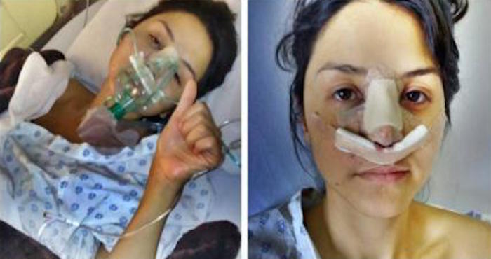 La modelo publicó imágenes de sus heridas en Facebook. Foto: Facebook.com/ximena.gaga