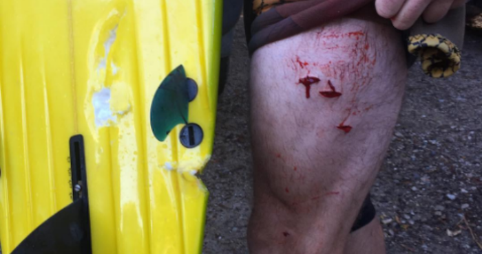 Los ataques de tiburón son comunes en Australia, donde habitan unas 180 especies de escualos. Foto: Instragram