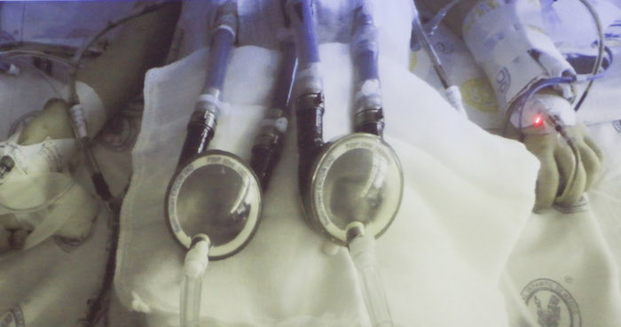 La pequeña de 4 años recibió el corazón artificial. Foto: Cuartoscuro/Saúl López.