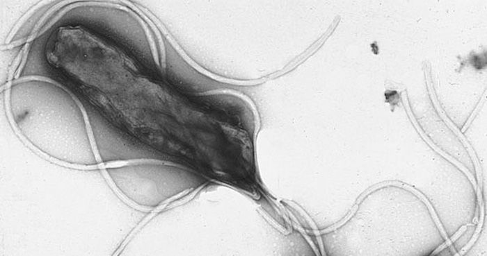 La ONU acordó por primera vez luchar contra las "superbacterias". Foto: Wikimedia Commons