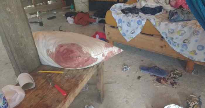 El niño de 11 años fue alcanzado por una bala perdida. Foto: Por Esto