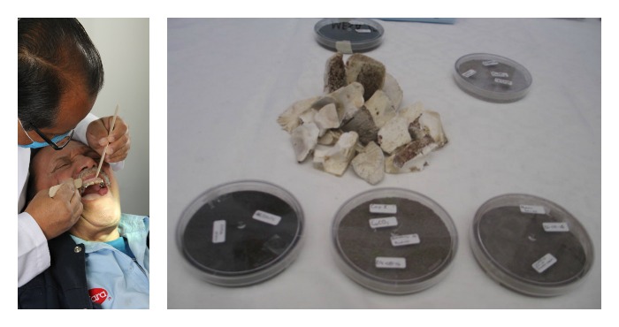 La hidroxiapatita (HAP) es un biocristal, formado por átomos de calcio, fósforo e hidrógeno, que está presente en dientes y huesos confiriéndoles su dureza característica. Foto: Especial /Cuartoscuro-Conacyt