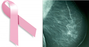 El método está diseñado para reducir los falsos positivos en el diagnóstico del cáncer de mama. Foto: Especial