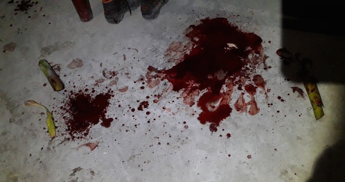 Un hombre hirió a otro dejándole una de cerca de 6 centímetros en el pene, en Papantla, Veracruz. Foto: Plumas Libres