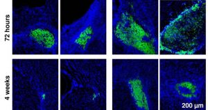 Biomaterial español contra el Alzheimer. Foto: TICbeat