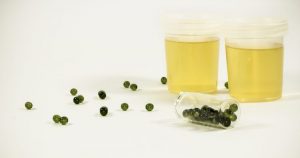 Esto es lo que el color de tu orina dice sobre tu estado de salud. Foto: TICbeat