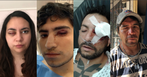 294 manifestantes en Chile sufrieron traumatismo ocular severo por perdigones y gases lacrimógenos. Foto: Especial, Vice