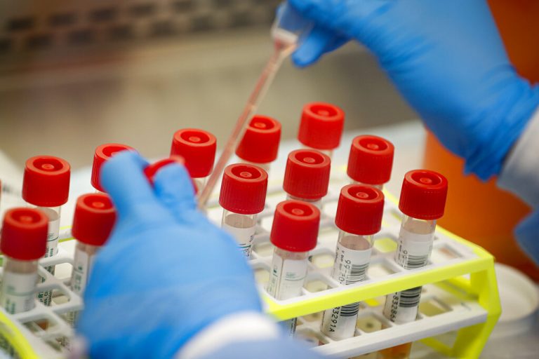 Un técnico trabaja con muestras usadas para detectar el coronavirus en un laboratorio de Nueva York el 11 de marzo del 2020. Una serie de fallas demoró la respuesta de EU al virus y facilitó su propagación, según expertos.