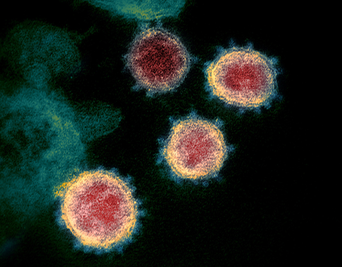 En esta imagen de archivo, tomada a través de un microscopio y sin fecha, distribuida por los Institutos Nacionales de Salud de Estados Unidos en febrero de 2020, se muestra el coronavirus que causa el COVID-19. 