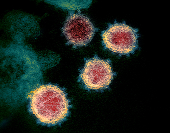 En esta imagen de archivo, tomada a través de un microscopio y sin fecha, distribuida por los Institutos Nacionales de Salud de Estados Unidos en febrero de 2020, se muestra el coronavirus que causa la COVID-19.