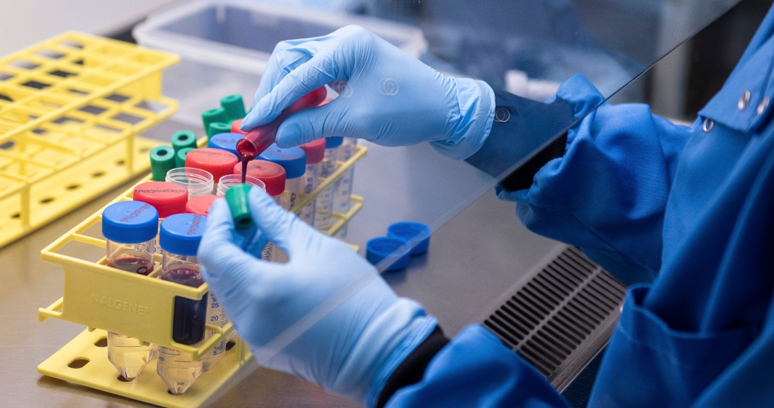 Se busca aumentar el acceso a la mayor cantidad posible de distintas vacunas efectivas, dada la enorme demanda y la aún limitada producción. Foto: John Cairns, Universidad de Oxford vía AP