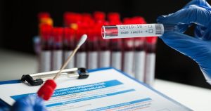 Las pruebas simples en casa contra el coronavirus podrían ser la clave para ampliar los test", expresó una investigadora. Foto: Shutterstock.