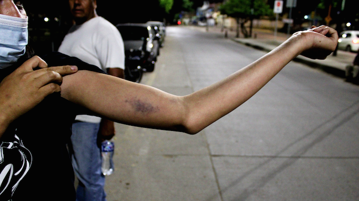 Las manifestantes fueron golpeadas por las autoridades en León, Guanajuato. 