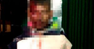 Al sujeto se le colocó una cartulina con un mensaje de advertencia a futuros ladrones. Foto: Pulso