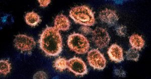 Esta imagen captada con un microscopio electrónico y proporcionada por el Instituto Nacional de Alergias y Enfermedades Infecciosas muestra partículas del virus SARS-CoV-2 que causan la COVID-19 aisladas de un enfermo en Estados Unidos. Foto: NIAID-RML vía AP