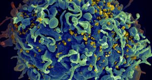 En esta imagen de archivo, distribuida por los Institutos Nacionales de Salud de Estados Unidos, se muestra una célula T humana (en azul) atacada por el VIH (en amarillo), el virus que causa el sida, al microscopio. Foto: Seth Pincus, Elizabeth Fischer, Austin Athman/Instituto Nacional de Alergias y Enfermedades Infecciosas/NIH vía AP 