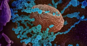 Se ha informado que la presencia de células B de memoria contra el coronavirus es de cinco a 10 veces más alta en las personas vacunadas después de la infección que la infección natural o la vacunación sola. Foto: NIAID-RML