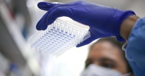 Para detectar anticuerpos frente al SARS-CoV-2 es necesario disponer de un antígeno derivado del virus. Foto: André Coelho, EFE