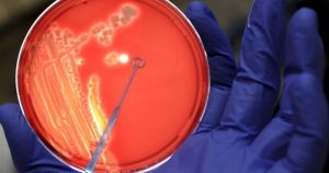 Un investigador examina una colonia de bacterias. Foto: Marius Becker, EFE