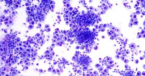 Foto: The Conversation