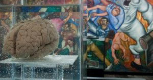 El cerebro es sólo una parte del sistema nervioso, que a su vez es sólo una parte del cuerpo. Foto: Diego Simón Sánchez, Cuartoscuro