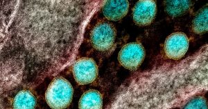 Micrografía de electrones del SARS-CoV-2. La identificación de una nueva variante del SARS-CoV-2 en Sudáfrica, caracterizada por un gran número de mutaciones. Foto: NIAID/National Institutes of Health