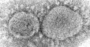 En esta imagen de archivo, distribuida por los Centros para el Control y Prevención de Enfermedades, se pueden ver partículas del virus SARS-CoV-2, causante de la COVID-19. Foto: Hannah A. Bullock, Azaibi Tamin/CDC vía AP