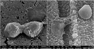 Esta abrumadora eficiencia fue registrada en pruebas con el estafilococo áureo, uno de los bacilos más resistentes a los antibióticos y más extendidos. Foto: Instituto Real de Tecnología de Melbourne
