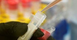 Las pruebas de antígeno son inmunoensayos que están diseñados, en su mayor parte, para detectar la presencia de la proteína N. Foto: Ted S. Warren, AP