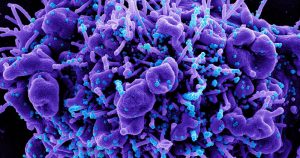 Micrografía coloreada de una célula infectada con el coronavirus (azul). Foto: NIAID