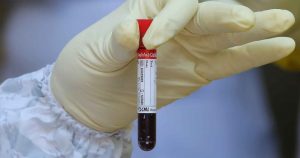 Analizar simplemente el gen AB0 por sí solo, como se ha hecho en este estudio, no nos indica absolutamente nada sobre la influencia del grupo sanguíneo en la COVID-19. Foto: Chamila Karunarathne, EFE/EPA