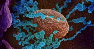 Los coronavirus son pequeños virus de ARN con una alta variabilidad. Foto: NIAID