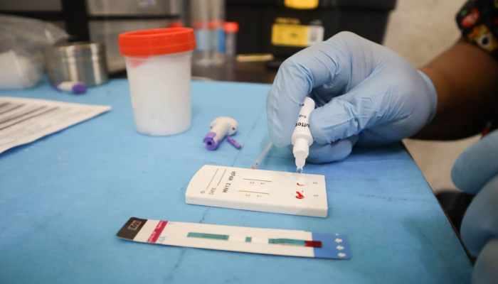 La organización “Una mano amiga en la lucha contra el Sida A.C. (UMALCS)” realiza pruebas para detectar el VIH.