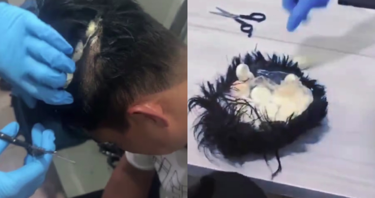 VIDEO ¬ Policía de Colombia detiene a hombre que ocultaba cocaína en una peluca.