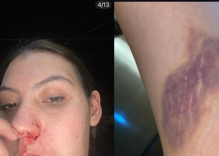 Imágenes de agresión de un estudiante a su novia.