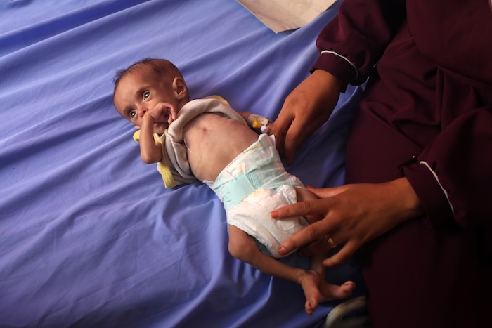 Las y los niños mueren de hambre en la Franja de Gaza ante la severa crisis desatada por la guerra mientras fábricas de armas obtienen ganancias récord.