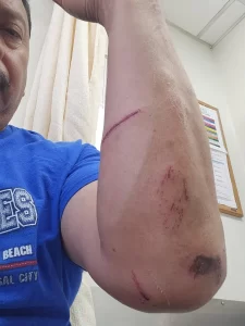 Juan Rivas muestra sus heridas.