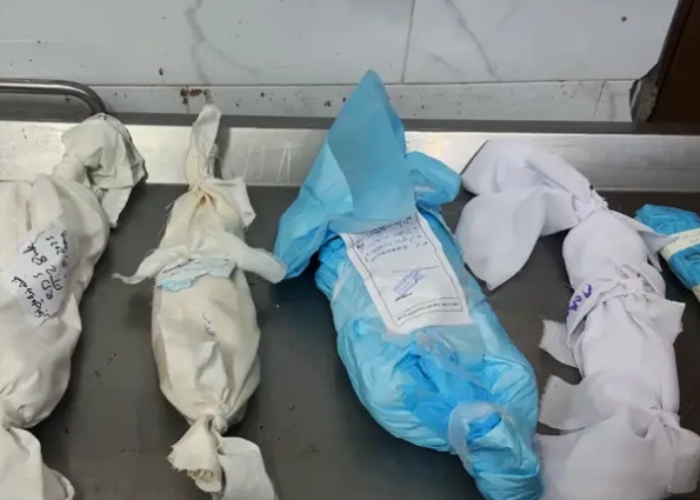 El número de palestinos muertos por hambre y desnutrición a causa de la ofensiva de Israel en la Franja de Gaza aumentó a 425, incluidos 145 niños. 