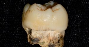 Estudio revela que antepasados humanos estuvieron expuestos al plomo hace millones de años