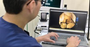 El síndrome del intestino irritable (SII) afecta a millones de personas en todo el mundo, causando dolor abdominal, inflamación y cambios en la digestión.