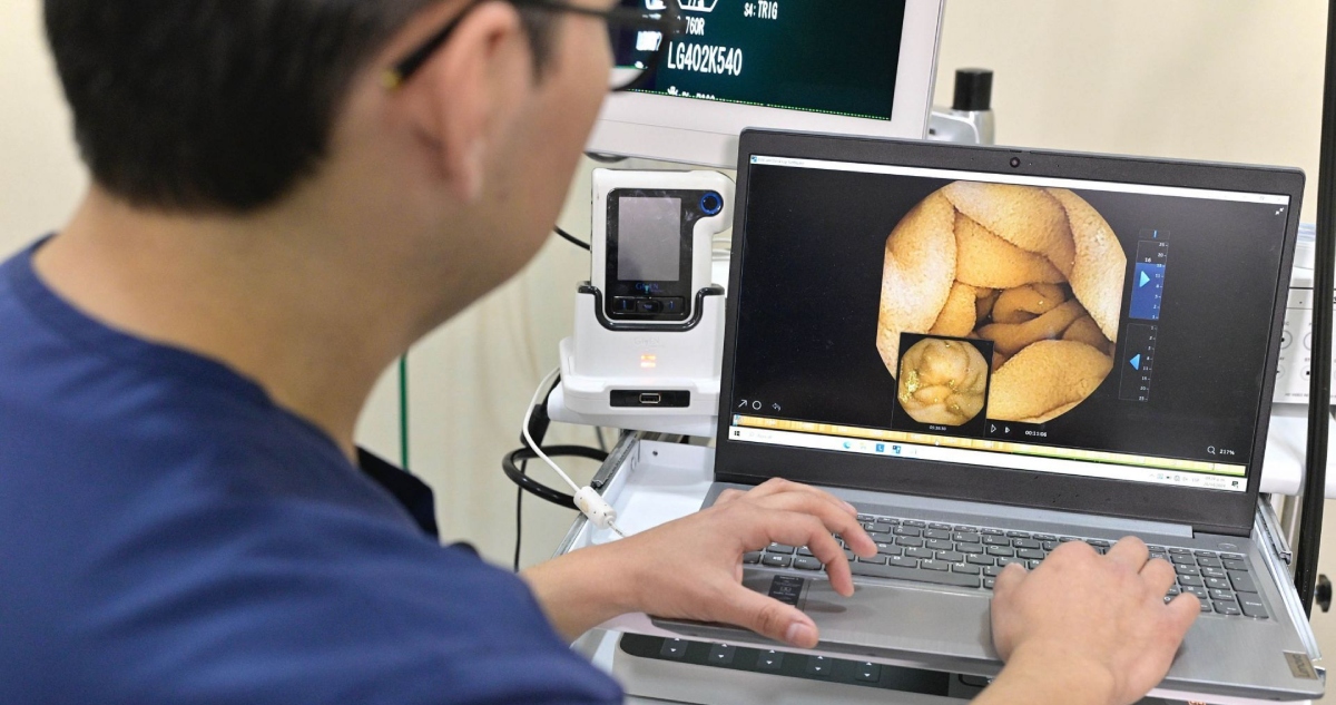 El síndrome del intestino irritable (SII) afecta a millones de personas en todo el mundo, causando dolor abdominal, inflamación y cambios en la digestión.