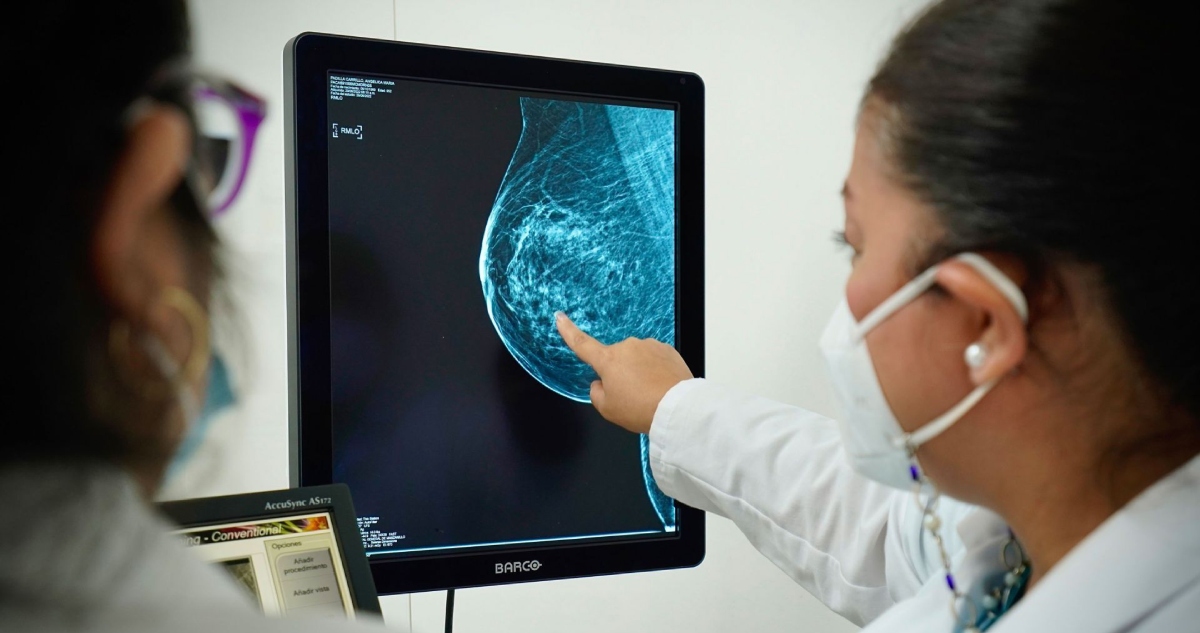 La especialista en Medicina Interna Daniela Silva llamó a visibilizar los signos menos conocidos del cáncer de mama, como los pequeños cambios en la piel.