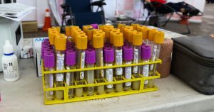 Una investigación coordinada por el Cáncer Center Clínica Universidad de Navarra (CCUN) desarrolló un método que detecta cáncer de pulmón en muestras de sangre.