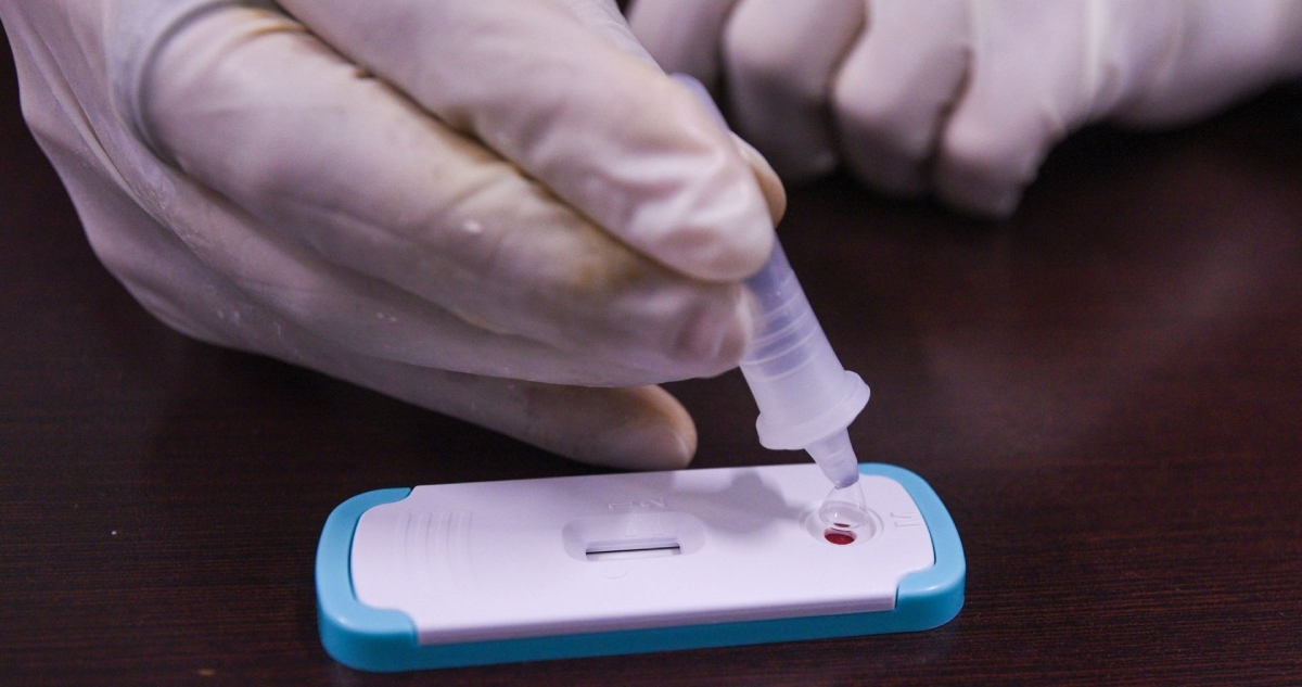 Científicos alemanes descubrieron 04_A06; un anticuerpo capaz de bloquear el acceso del VIH a las células.