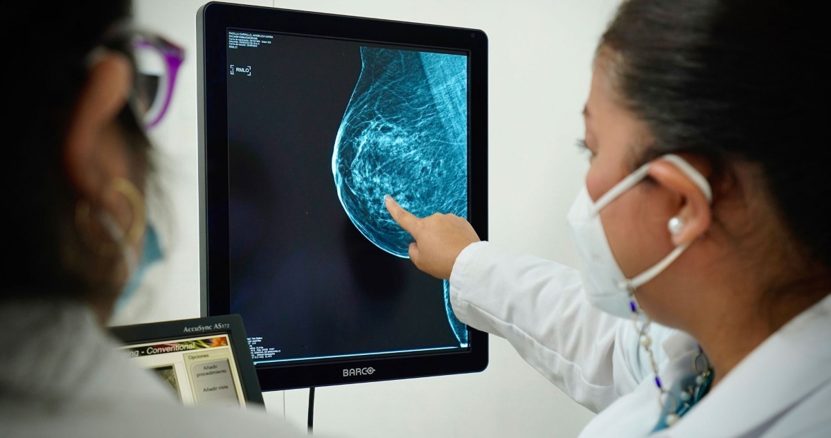 Exploración de cáncer de mama