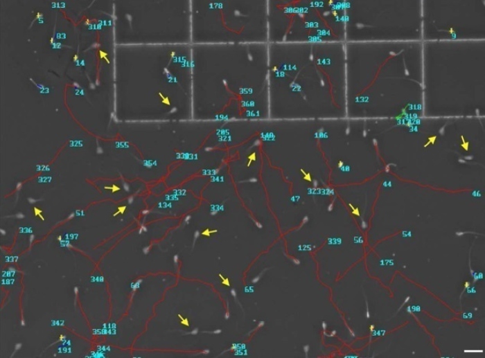 Muestra de esperma analizada por la Universidad de Castilla-La Mancha