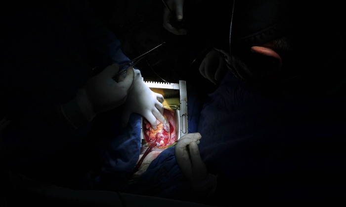 Instituto Mexicano del Seguro Social (IMSS) llama a cuidar la salud del corazón. Foto: IMSS