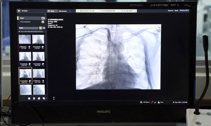 Instituto Mexicano del Seguro Social (IMSS) llama a cuidar la salud del corazón. Foto: IMSS