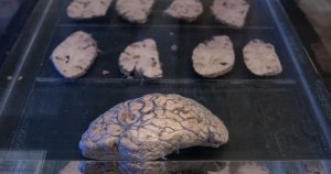 Mapa del Cerebro humano.